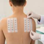 Câmaras do teste de contato fixadas nas costas de um adolescente por uma profissional de saúde